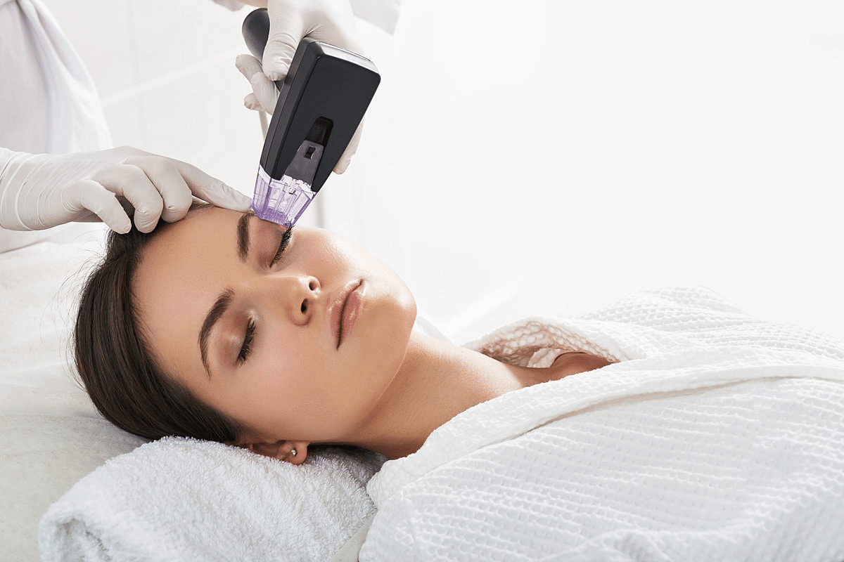 A clinician performing a Morpheus8 fractional RF microneedling treatment on a patient's forehead.