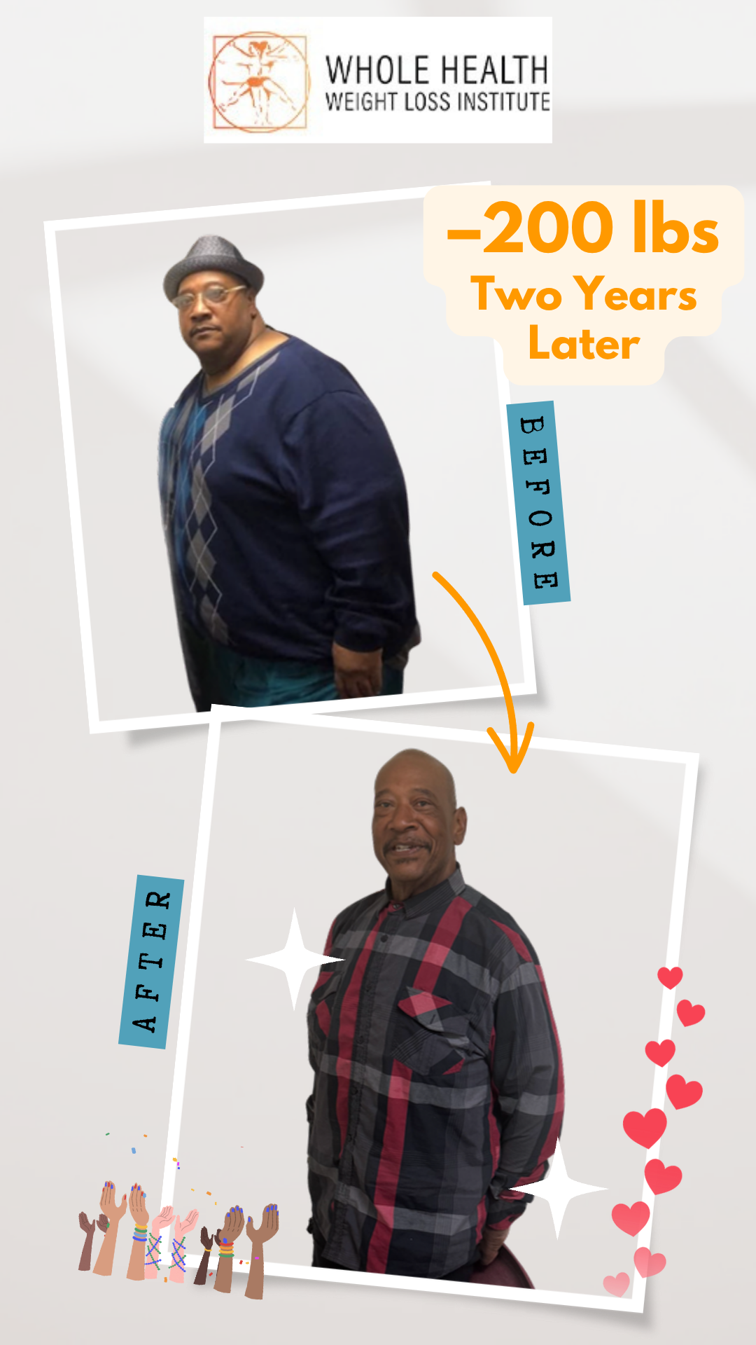 Before and after photos of Robert showing 200 lbs weight loss after gastric sleeve surgery at Whole Health Weight Loss Institute