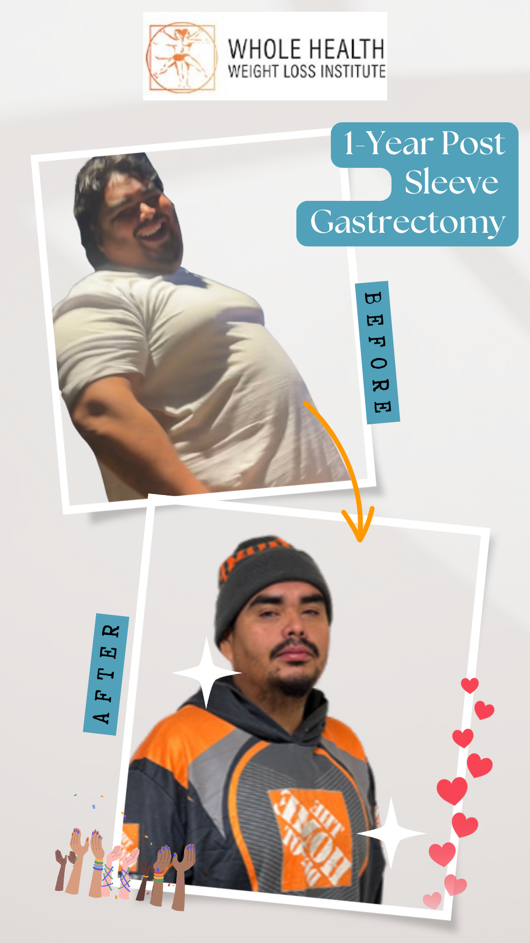 Before and after photos of Bryan showing 133 lbs weight loss after gastric sleeve surgery at Whole Health Weight Loss Institute
