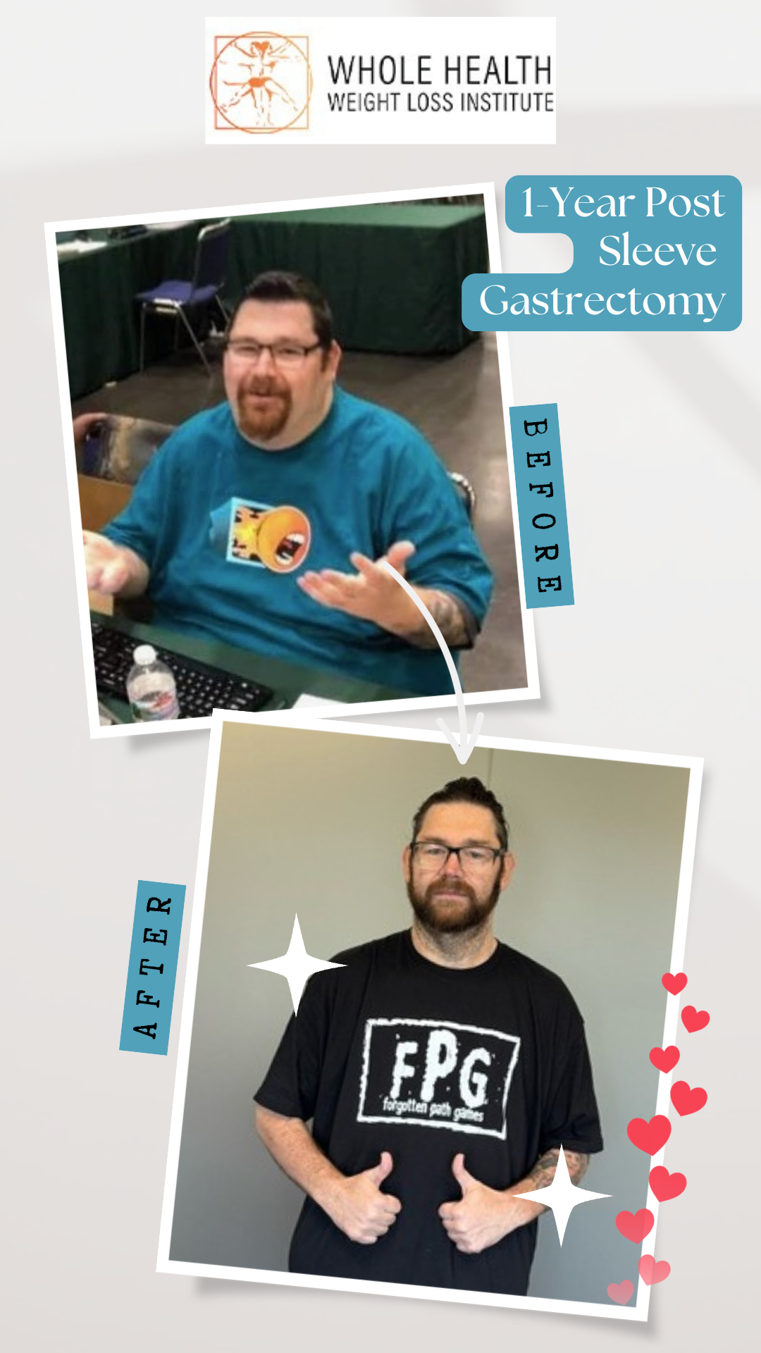 Before and after photos of Edward showing 140 lbs weight loss after gastric sleeve surgery at Whole Health Weight Loss Institute
