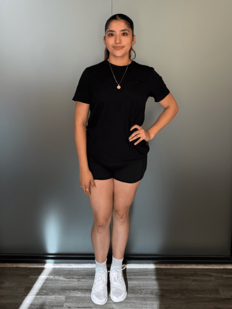 Evelyn after Sleeve Gastrectomy