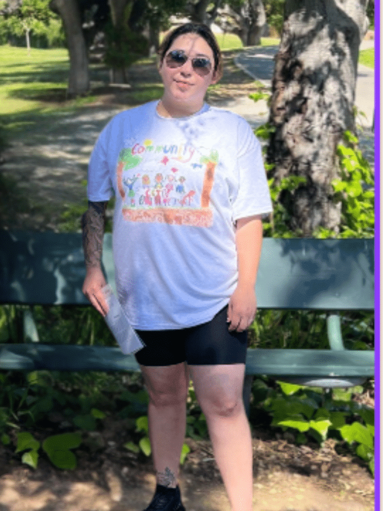 Evelyn before Sleeve Gastrectomy