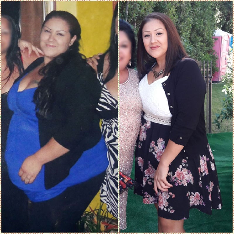 Anonymous patient before and after