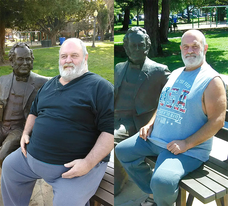 Anonymous patient before and after