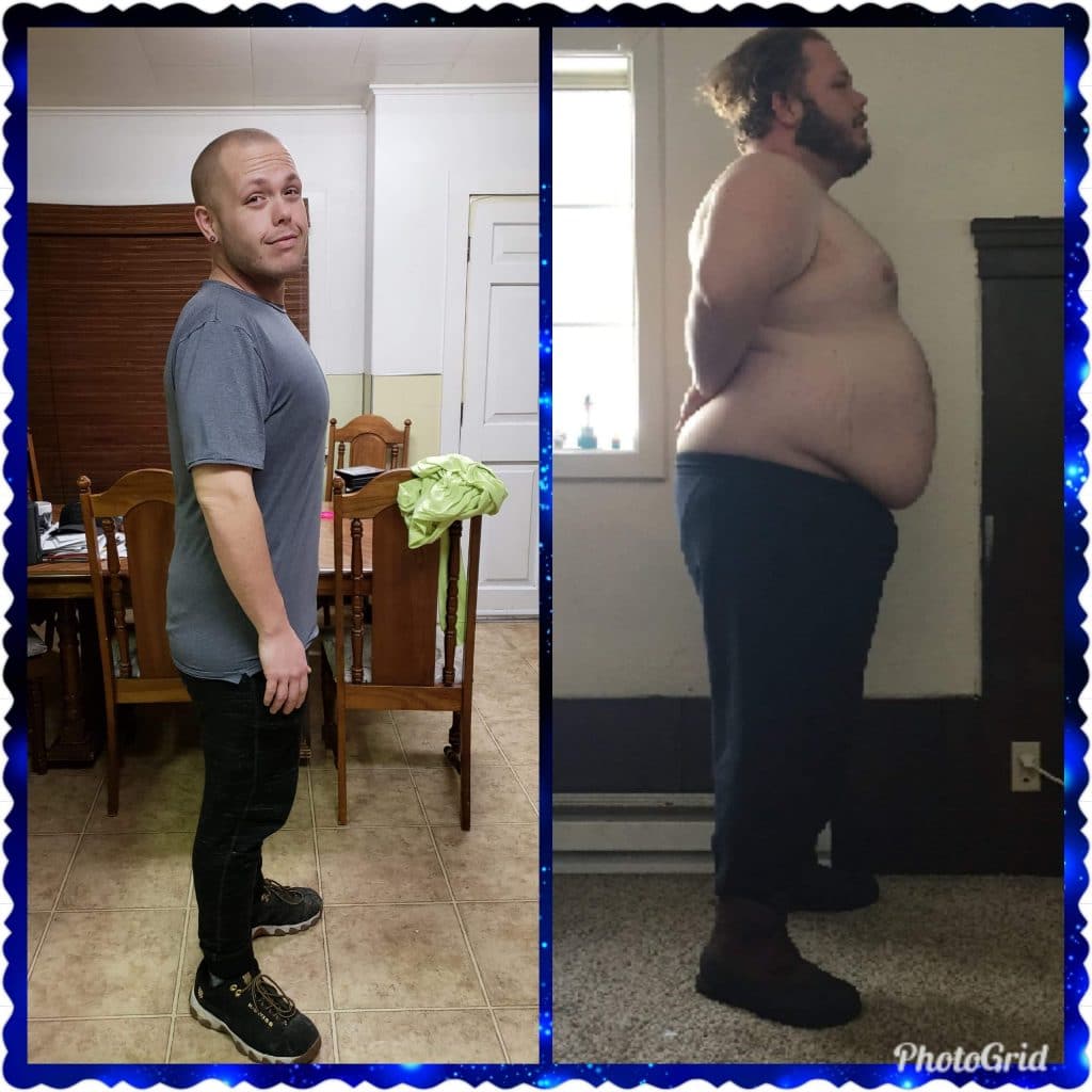 Anonymous patient before and after
