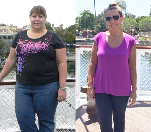 GLP-1 Medications before-and-after result