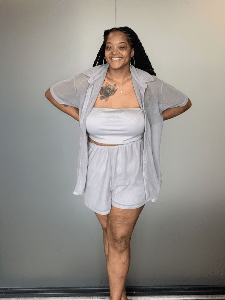 Jade after Sleeve Gastrectomy