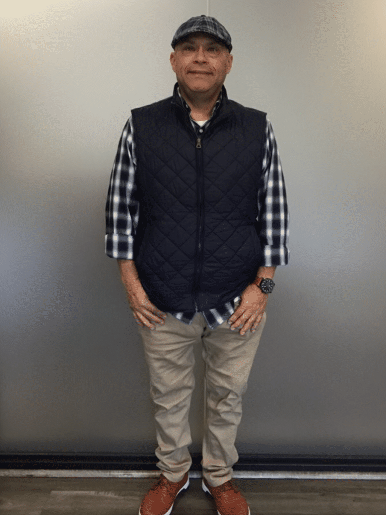 Paul after Sleeve Gastrectomy