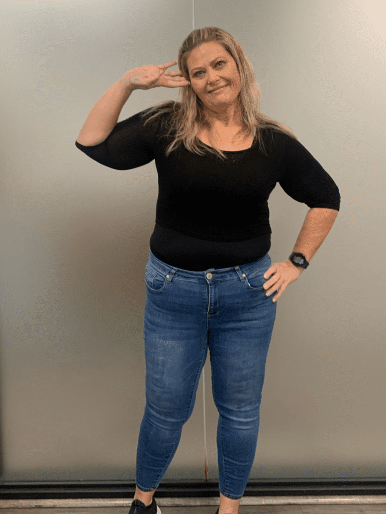 Pauline after Sleeve Gastrectomy
