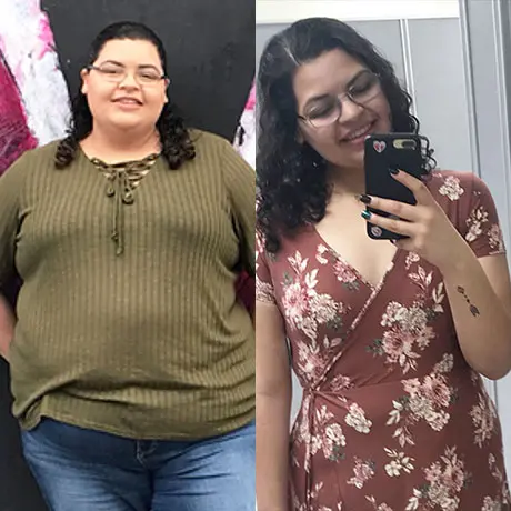Anonymous patient before and after bariatric surgery