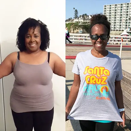 Anonymous patient before and after bariatric surgery